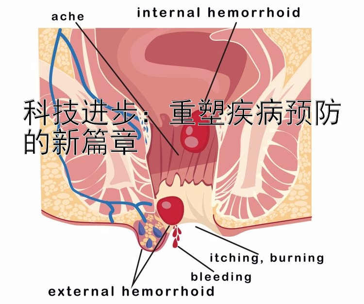 科技进步：重塑疾病预防的新篇章